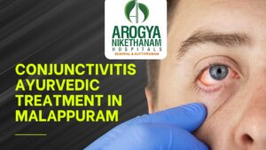Person gently washing their eye with Triphala herbal eyewash for conjunctivitis relief