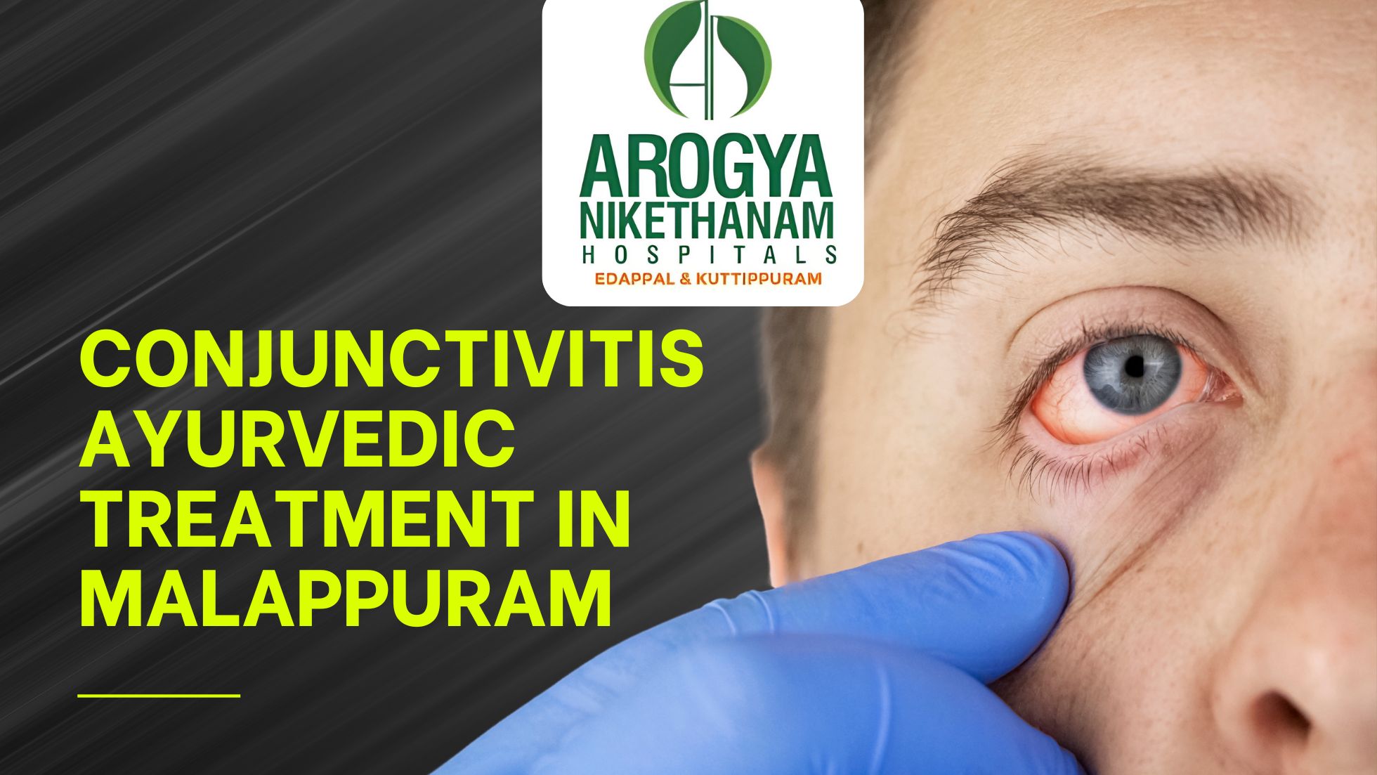 Person gently washing their eye with Triphala herbal eyewash for conjunctivitis relief
