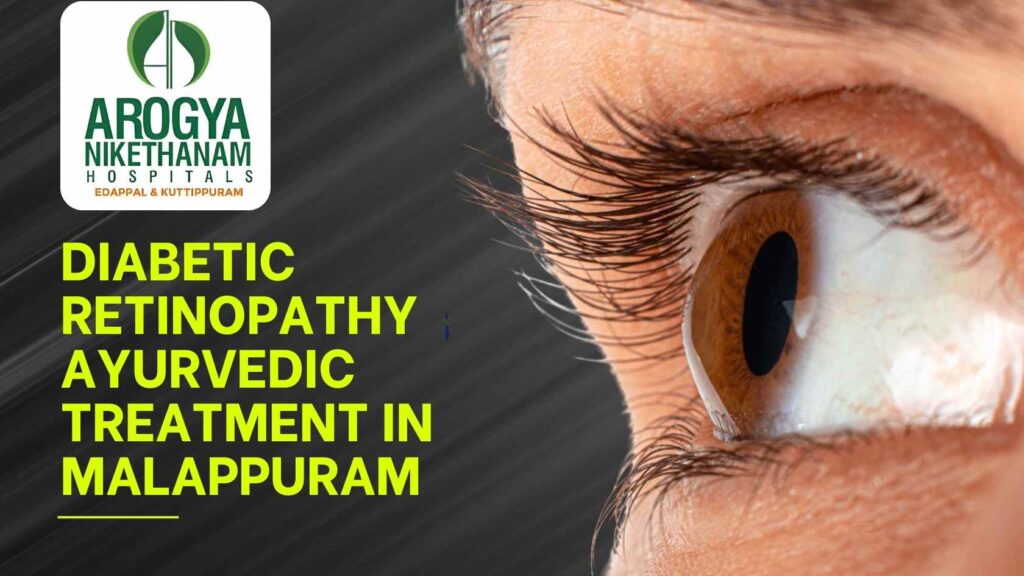Patient receiving Netra Tarpana Ayurvedic eye therapy at Arogya Nikethanam Hospital, Malappuram