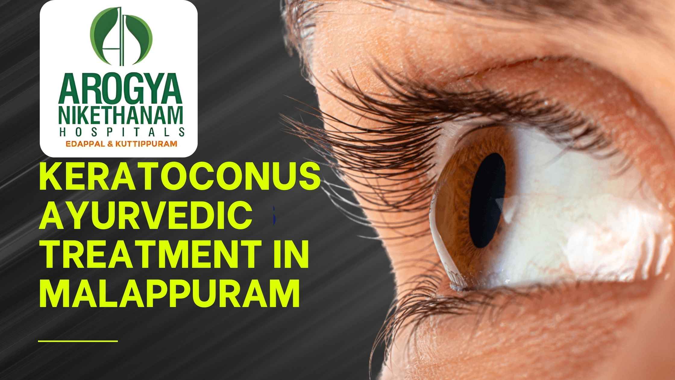 Ayurvedic eye therapy (Netra Tarpana) being performed at Arogya Nikethanam Ayurveda Hospital in Malappuram