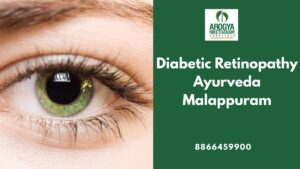 "Ayurvedic doctor performing eye treatment for diabetic retinopathy Ayurveda Malappuram at Arogya Nikethanam Hospital"